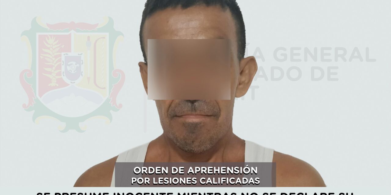 APTURADO EN ACAPONETA POR LESIONES CALIFICADAS