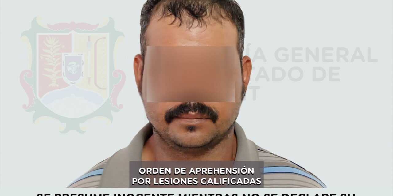 📢 #Boletín | CAPTURADO EN SANTIAGO IXCUINTLA POR LESIONES CALIFICADAS