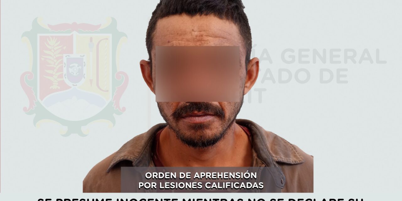 DETENIDO EN AMATLÁN DE CAÑAS POR LESIONES CALIFICADAS