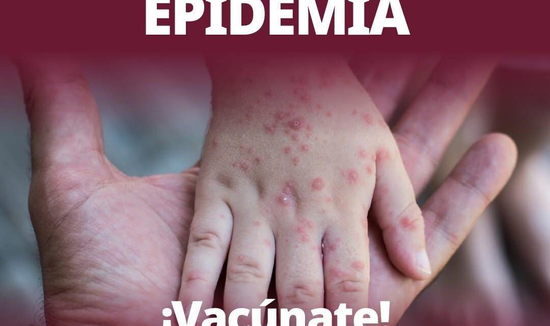 SARAMPIÓN: VACUNARSE ES PROTEGER LA VIDA