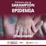 ¡QUE LA DUDA NO SEA UN RIESGO: VACÚNATE CONTRA EL SARAMPIÓN!