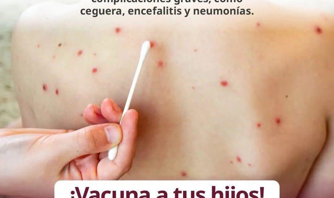 ¡PROTÉGETE CONTRA EL SARAMPIÓN! VACUNARSE ES PREVENIR